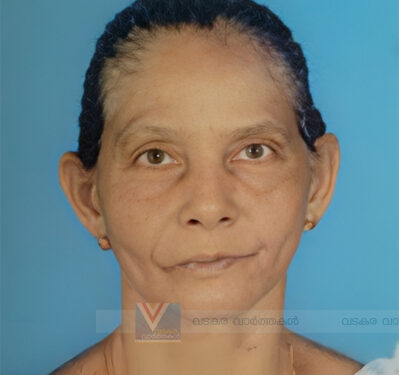 ചോറോട് ഈസ്റ്റ് എടക്കണ്യാറത്ത് മീത്തല്‍ മന്ദി അന്തരിച്ചു