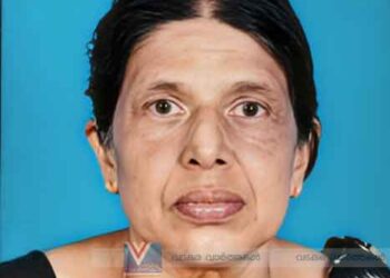 അഴിയൂര്‍ തോട്ടത്തില്‍ രമ അന്തരിച്ചു