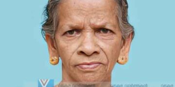 വിലാതപുരം ചെറിയാലത്ത് ലക്ഷ്മിക്കുട്ടി അമ്മ അന്തരിച്ചു