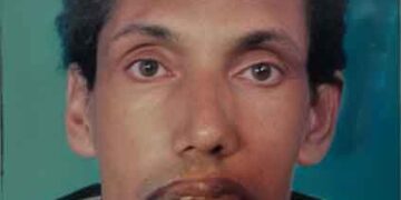 കടമേരി രയരോത്ത് കുന്നത്ത് അബ്ദുല്ല അന്തരിച്ചു