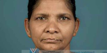 പതിയാക്കര കിഴക്കേ നടേമ്മല്‍ രാധ അന്തരിച്ചു