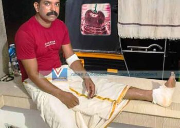 അരൂര്‍ മേഖലയില്‍ കാട്ടുപന്നി വിളയാട്ടം; അക്രമത്തില്‍ ഒരാള്‍ക്ക് പരിക്ക്, ജനം പൊറുതി മുട്ടി