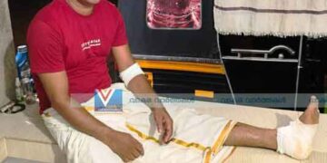 അരൂര്‍ മേഖലയില്‍ കാട്ടുപന്നി വിളയാട്ടം; അക്രമത്തില്‍ ഒരാള്‍ക്ക് പരിക്ക്, ജനം പൊറുതി മുട്ടി
