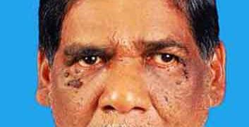 എളയടം മേലേടത്ത് കുമാരന്‍ അന്തരിച്ചു
