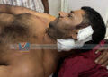 സ്കൂട്ടര് തടഞ്ഞ് യാത്രക്കാരനെ കുത്തിപരിക്കേല്പ്പിച്ചു